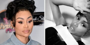 Blac Chyna Revealed She Recently Got Her Breast Implants Reduced Again, And It Led To Some Serious Health Complications