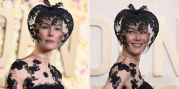 Rosamund Pike Turned A Horrific Ski Accident Into A Fashion Statement — It's The Creativity For Me
