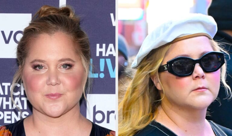 Amy Schumer Diagnosed With Cushing Syndrome